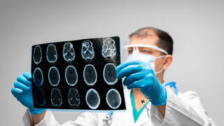 רופא מפענח צילום רנטגן דימות