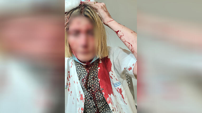 הרופאה שהותקפה בידי מטופל בכללית באר יעקב