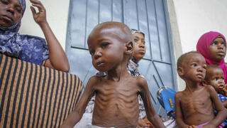 סומליה רעב משבר מזון מרכז לטיפול ב תת תזונה מוגדישו