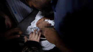 גופת ילד פלסטיני עלאא קודום בבית החולים שיפא  בעזה 