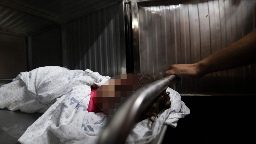 גופת ילדה פלסטיני בבית החולים שיפא  בעזה 