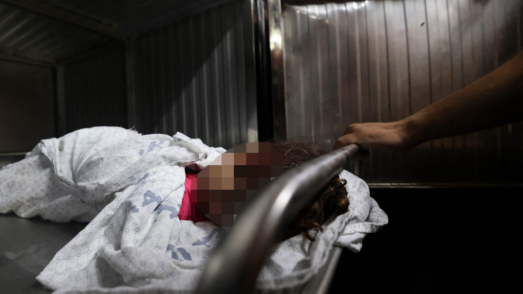 גופת ילדה פלסטיני בבית החולים שיפא  בעזה 