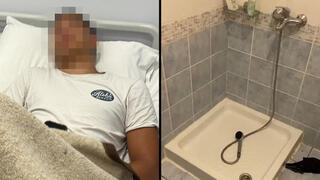 מימין: מקלחת מטונפת עם מים מסריחים. משמאל: אחד מהנערים שחלו
