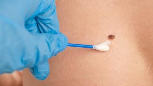 Фото: shutterstock