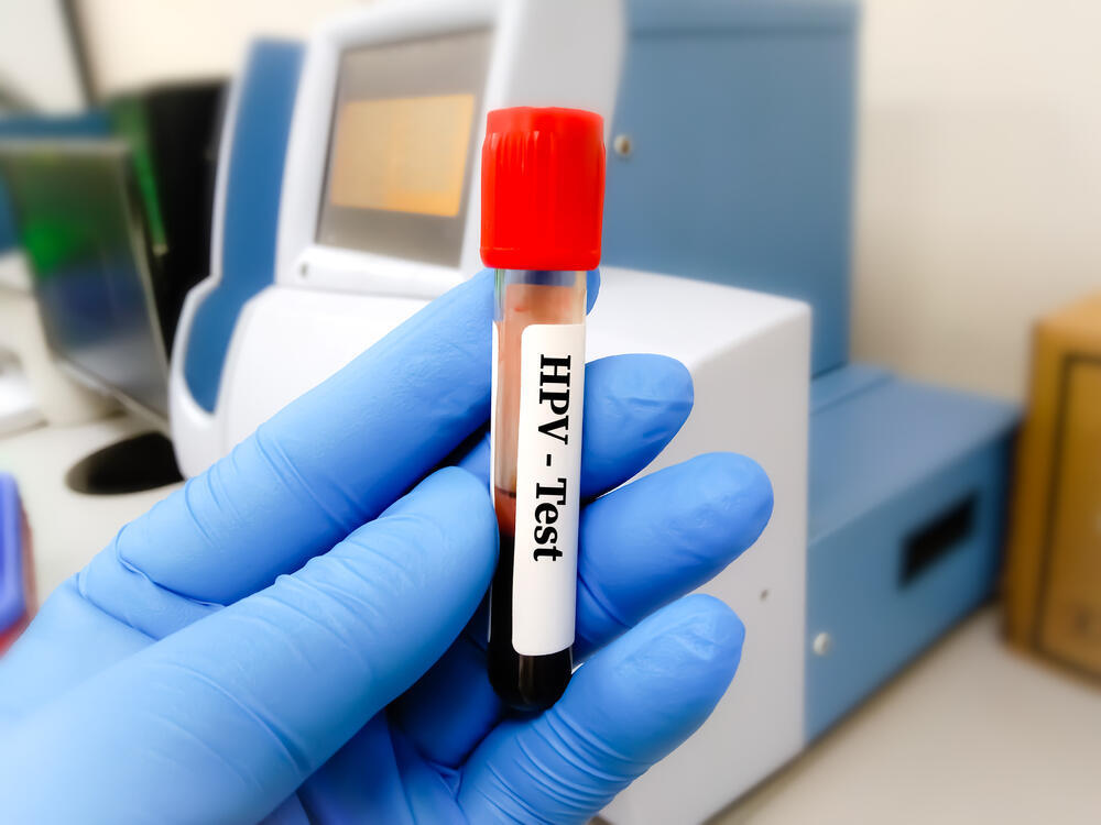HPV-тест на выявление рака шейки матки 