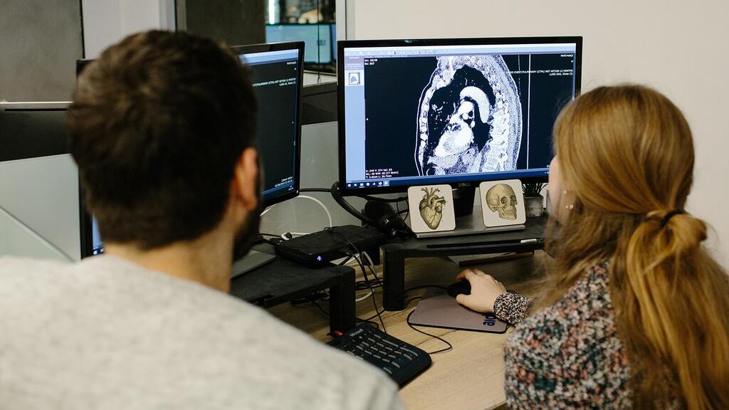 מערכת Aidoc בינה מלאכותית פענוח בדיקות CT