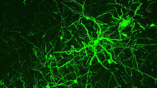 נוירונים של שליו שהודבקו בנגיף שפיתחו חוקרי הטכניון. על גבי הנוירונים אפשר לראות מבנים הקרויים spines 