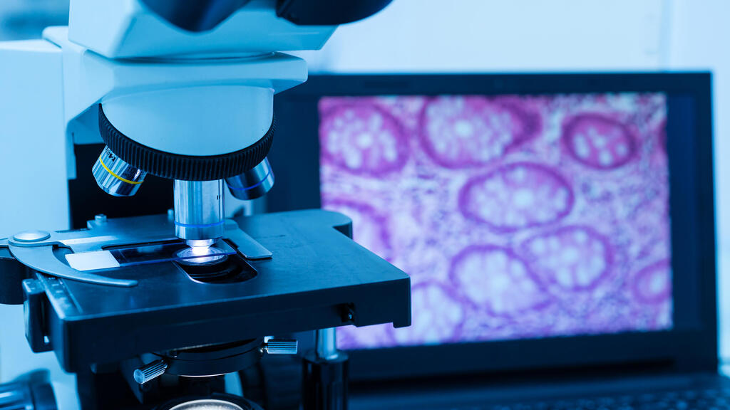 Лаборатория. Иллюстрация (Фото: shutterstock) אילוס אילוסטרציה מעבדה פתולוגית