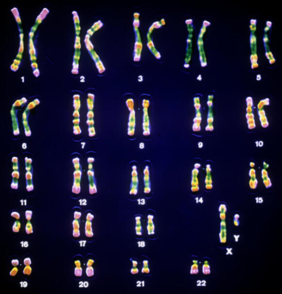 In all mammals, females have a pair of X chromosomes, while males possess one X chromosome and one Y chromosome. Microscopic image of a male’s chromosome pairs, with the sex chromosomes positioned at the bottom right 