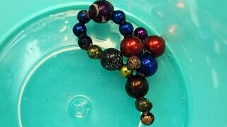 פעוט אכל שרשרת ונזקק לניתוח לכריתת חלק מהמעי