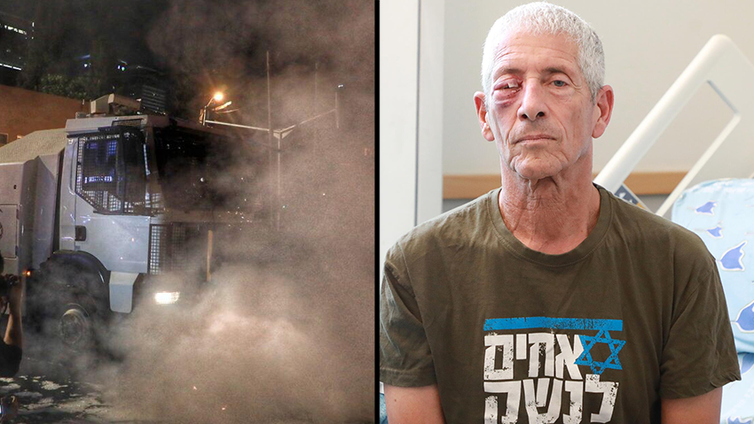 הפצוע מההפגנה אודי אורי