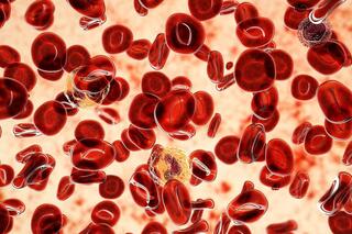 תאי דם מחלת פוליציטמיה ורה
