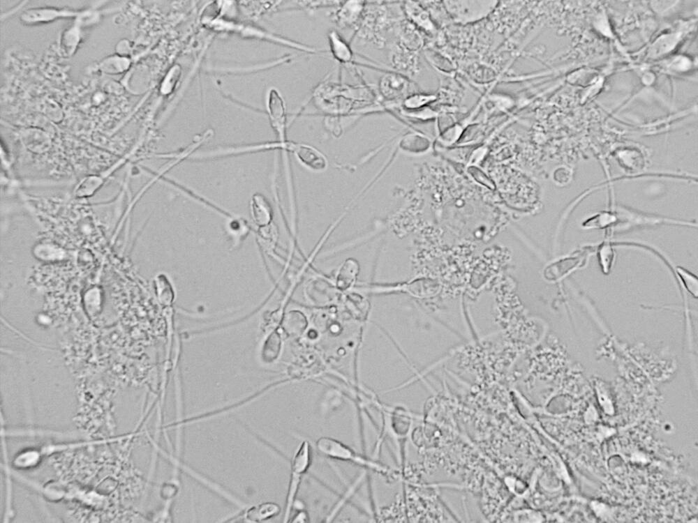תאי זרע מתחת למיקרוסקופ