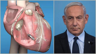 Кардиостимулятор, имплантированный премьеру, Биби Нетаниягу 