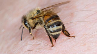 עקיצת דבורה דבורים