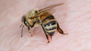 עקיצת דבורה דבורים