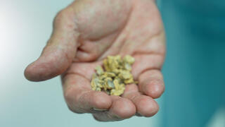 אבנים בכליה אבנים בכליות