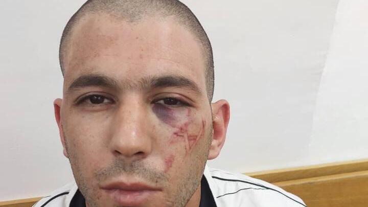  תושב מזרח ירושלים החשוד בעבירות סחר בסמים פצוע במעצרו