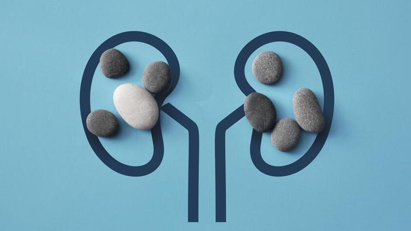 Фото: shutterstock