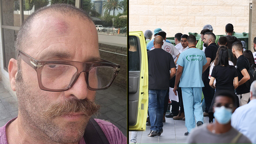 לוחם מג"ב הפצוע מגיע למרכז הרפואי מאיר מבילינסון