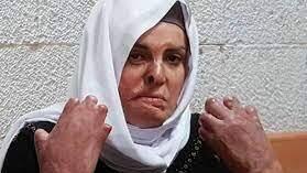 אסראא ג'אבעס