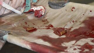 בית החולים ברזילי באשקלון ב-7 באוקטובר