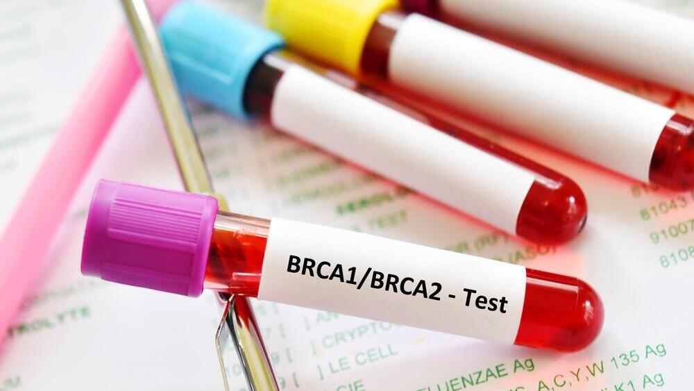 Анализ BRCA - это всего лишь анализ крови, позволяющий выявить мутации в генах 