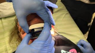 מכונת קיצוץ ציפורניים חשמלית נתפסה בשפתיים של ילדה בת 5