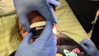 מכונת קיצוץ ציפורניים חשמלית נתפסה בשפתיים של ילדה בת 5