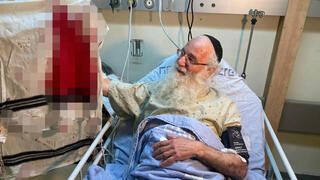הרב צבי טל, נפצע בפיגוע הדקירה בנווה יעקב