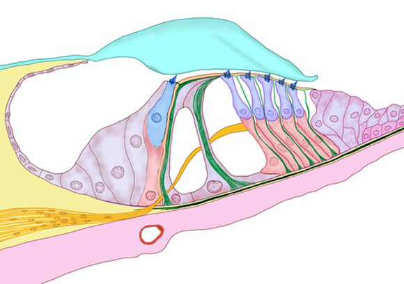 Damage to the activity of the cochlear nerve (orange) may contribute to tinnitus. Corti's organ within the cochlea: Hair cells (blue) respond to sound wave vibrations by transmitting a nerve signal 
