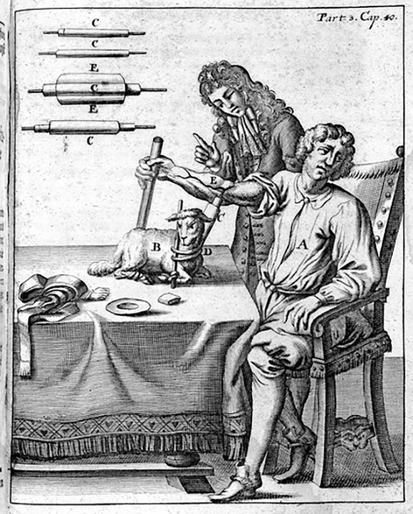 In the early attempts to perform blood transfusion in humans, Lower used animal blood. An illustration from 1692 describing blood transfusion between a lamb and a human