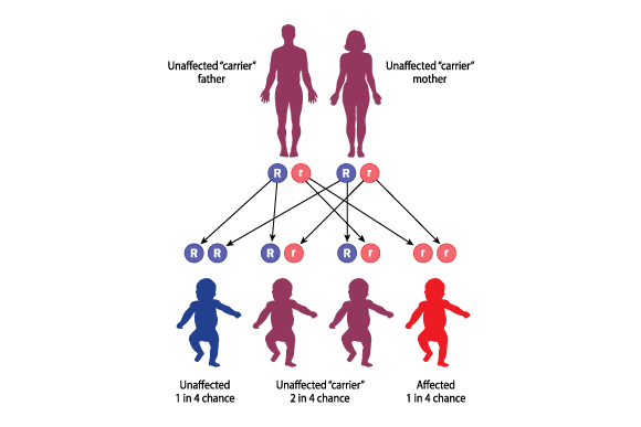 The inheritance of recessive genetic diseases, such as cystic fibrosis. The probabilities of parents who are carriers to have healthy or sick children   
