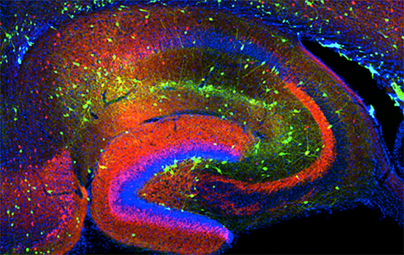 An organ of paramount importance for memory formation, storage and retrieval. A cross-section of a mouse hippocampus, where cell nuclei are stained in blue and various proteins are stained in red and green 