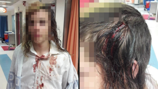 חשד: בן 14 הוכה על ידי שוטר באמצעות אלה בראשו בליל יום ירושלים