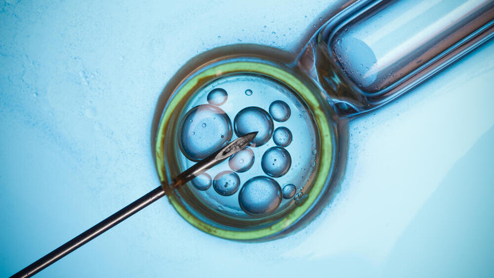 הפריה חוץ גופית IVF