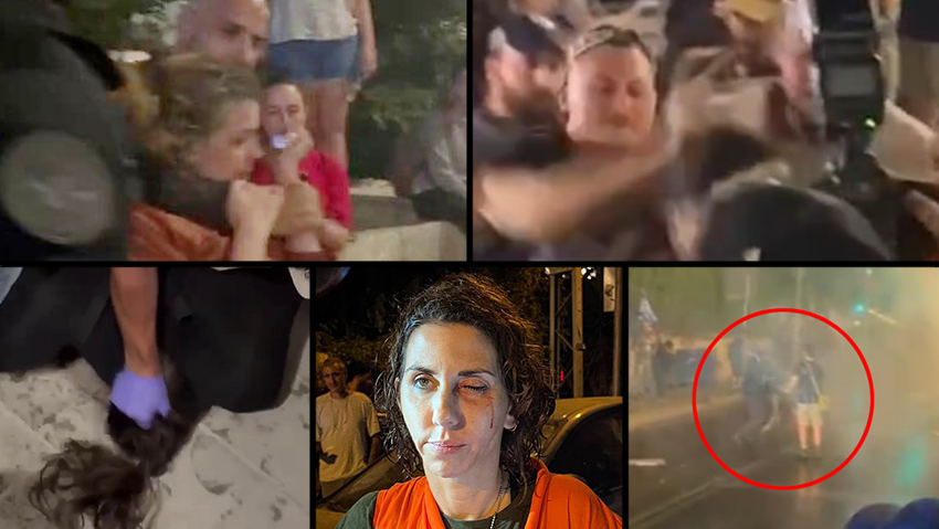 אלימות משטרתית בהפגנה בירושלים