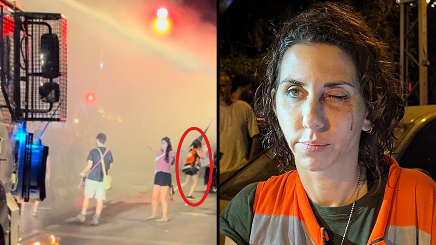ד"ר טל וייסבאך נפגעה מכת"זית ליד בית ראש הממשלה רחוב עזה ירושלים