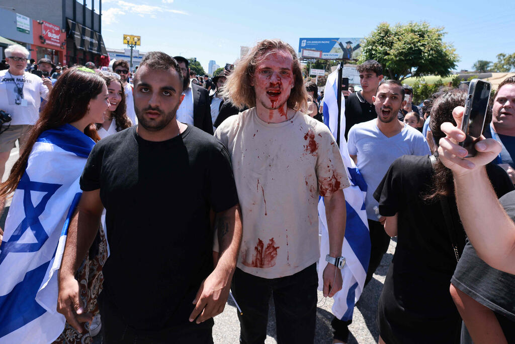 Israel supporters attacked by pro-Palestinian mob on the streets of Los Angeles (Photo: DAVID SWANSON / AFP) עימותים בין פרו-פלסטינים לתומכי ישראל ברחובות לוס אנג'לס