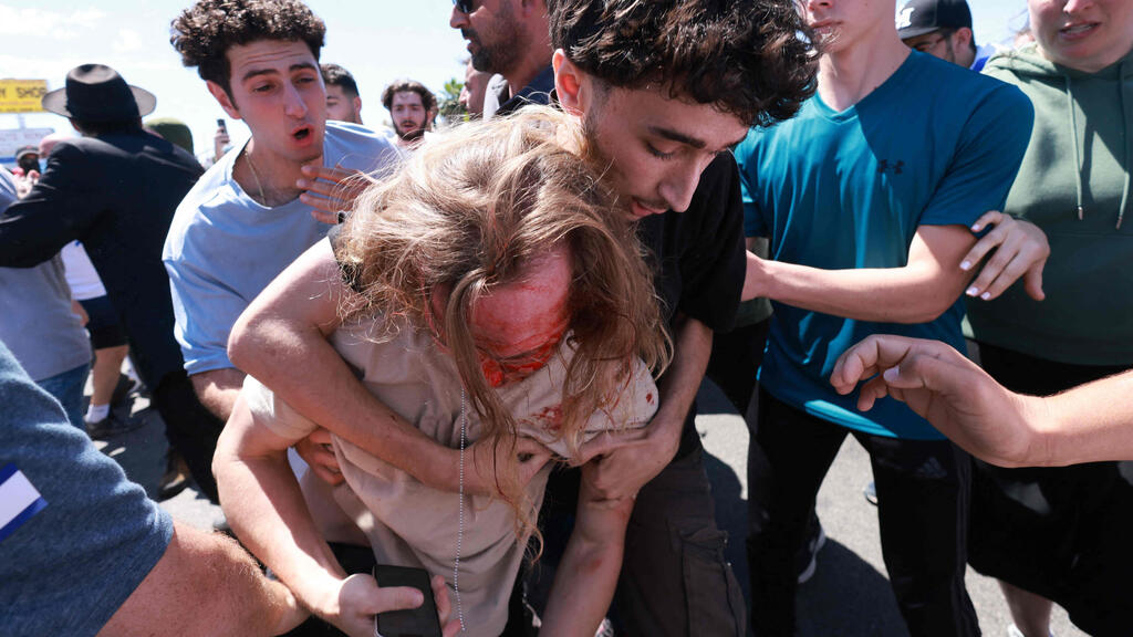 Violent clashes between opponents and supporters of Israel in L.A. (Photo: David Swanson / AFP) עימותים בין פרו-פלסטינים לתומכי ישראל ברחובות לוס אנג'לס