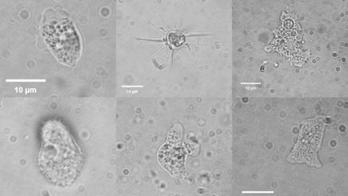 צילומי מיקרוסקופ של מינים שונים של אמבות שנמצאו במעיינות באזור הכינרת. למטה במרכז מתועדת אמבה מאותו הסוג של האמבה אוכלת המוח
