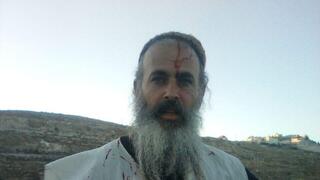 הפצוע שניצל מהפיגוע סמוך לבית ענון