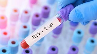 בדיקת HIV