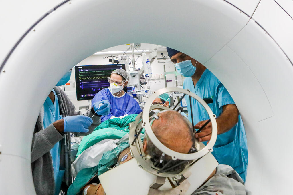 ניתוח מוח אפילפסיה בילינסון