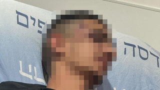 תושב מזרח ירושלים הגיש תלונה במשטרה על זה שהוכה  באכזריות בתוך מחסום  על ידי אנשי הבידוק