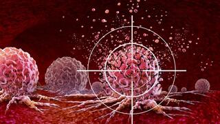 סרטן תאים טיפול ממוקד