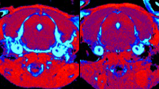סריקת MRI מוח בעכבר עם מחלת גושה סוג 3 שקיבל טיפול גנטי (מימין) ובעכבר חולה שלא טופל (משמאל). הסריקה חושפת הפחתה משמעותית ברמת הדלקתיות ברקמה (מסומנת בתכלת) בעכבר שטופל 