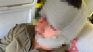 לוחם נפצע מבקבוק תבערה שהשליכו עליו מתנחלים ליד גבעת אסף