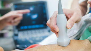 בדיקת אקו לב