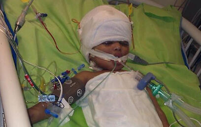 תינוקת אריתראית נדקרה דקירה ב ראש ירושלים